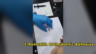 Kieferorthopädisches Bindungssystem