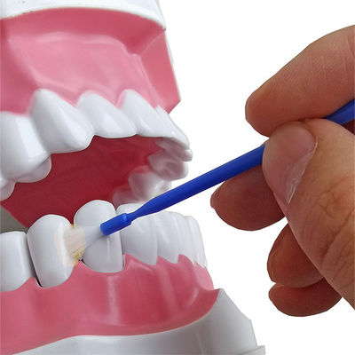 Fluorid-Lack 10g 5%NaF treffen auf Zahn remineralization und Prevebts-Karies CER zu