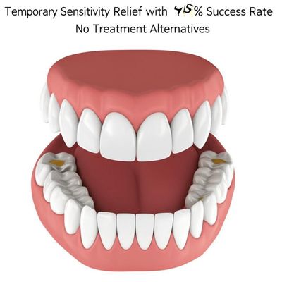 quality Temporary Sensitivity Relief Root Canal Therapy with 95% Success Rate and No Treatment Alternatives factory